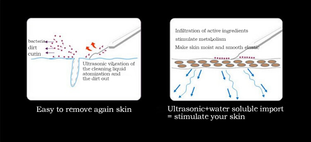 2016-Deeply-ultrasonic-face-skin-cleaner-device-blackhead-removal-Device-shovel-machine-face-exfolia-32464659764
