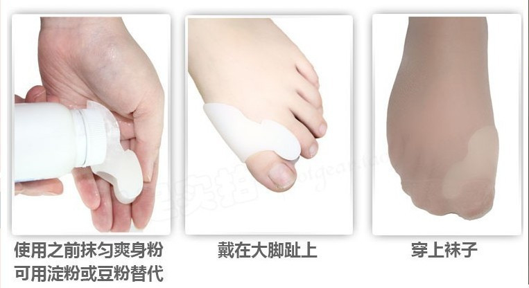 2Pcs1-Pair-Silica-Beetle-crusher-Bone-Ectropion-Adjuster-Toes-Outer-Appliance-Toes-Separator-Foot-Ca-1921248883