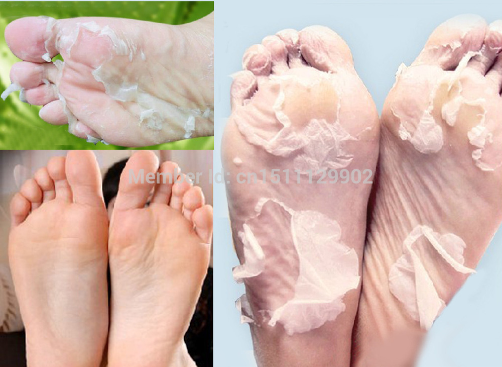 5pair10pcs-Baby-Feet-Skin-Smooth-Exfoliating-Foot-Mask-Foot-Care-Mask-Foot-Care-Health-Care-Pedicure-1887256683