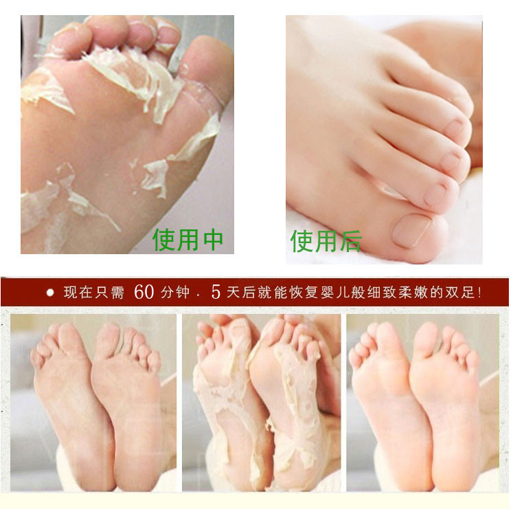 5pair10pcs-Baby-Feet-Skin-Smooth-Exfoliating-Foot-Mask-Foot-Care-Mask-Foot-Care-Health-Care-Pedicure-1887256683