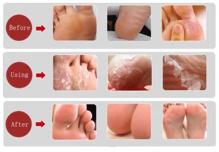 6Packs-Hot-Sale-Baby-Foot-Peeling-Mask-Exfoliating-Socks-For-Pedicure-Sosu-Exfoliating-Foot-Care-Dea-32426491961