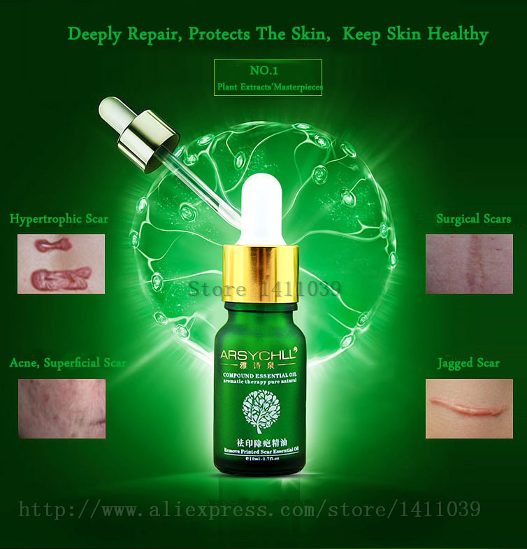 Face-Care-Acne-Scar-Removal-Cream-Acne-Spots-Skin-Care-Treatment-Stretch-Marks-Whitening-Remove-Acne-2030469034
