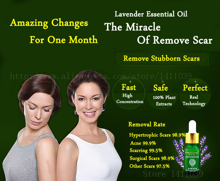 Face-Care-Acne-Scar-Removal-Cream-Acne-Spots-Skin-Care-Treatment-Stretch-Marks-Whitening-Remove-Acne-2030469034