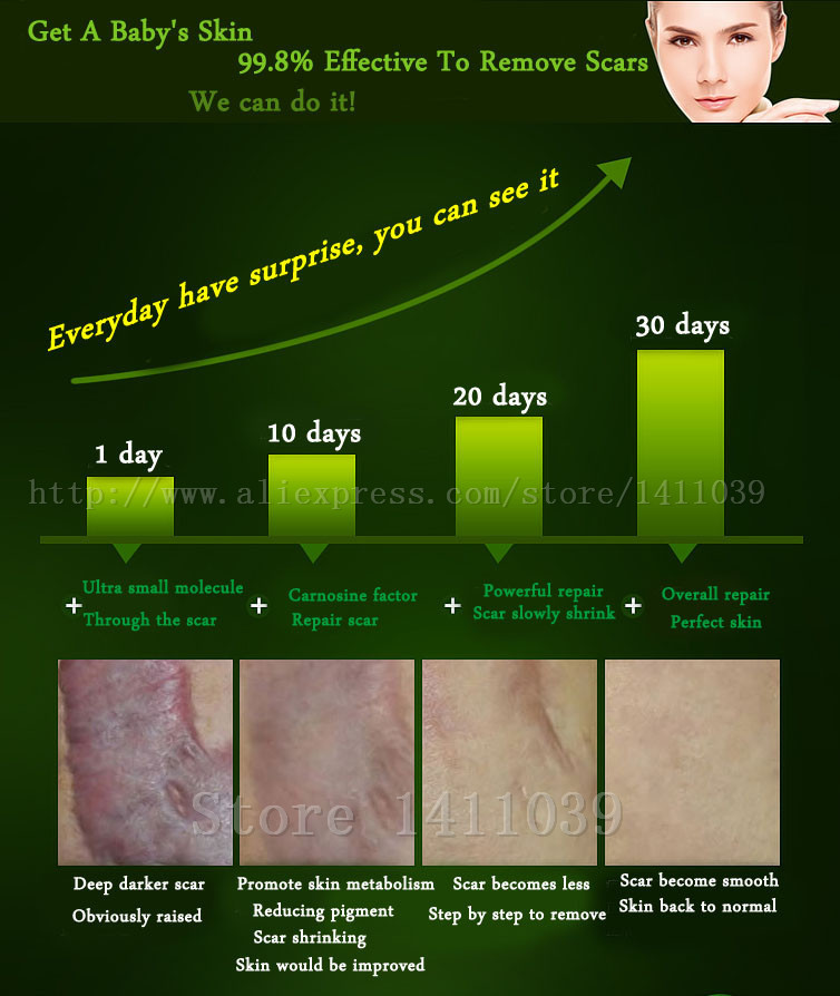 Face-Care-Acne-Scar-Removal-Cream-Acne-Spots-Skin-Care-Treatment-Stretch-Marks-Whitening-Remove-Acne-2030469034
