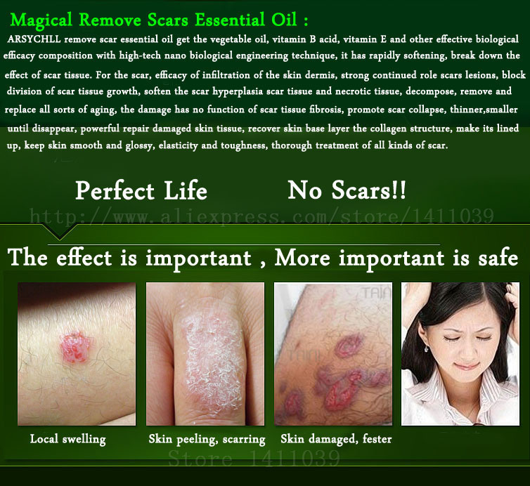Face-Care-Acne-Scar-Removal-Cream-Acne-Spots-Skin-Care-Treatment-Stretch-Marks-Whitening-Remove-Acne-2030469034