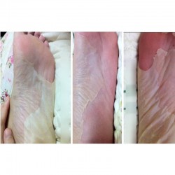 8pcs=4bag Baby Foot Peeling Exfoliating Foot Mask Sox Remove Dead Skin As Beauty Foot Care Pedicure Socks Sosu